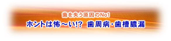 歯を失う原因のＮｏ１ ホントは怖～い！？　歯周病・歯槽膿漏