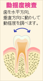 動揺度検査