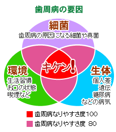 歯周病の要因